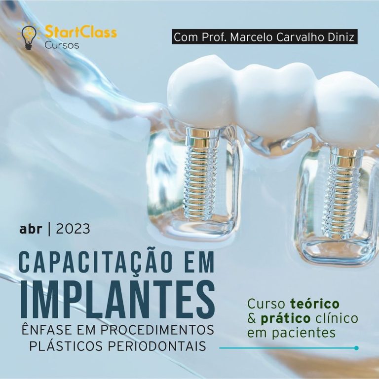 CAPACITAÇÃO EM IMPLANTES – COM ÊNFASE EM PROCEDIMENTOS PLÁSTICOS PERIODONTAIS